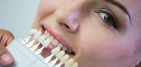 Tooth colored filling