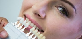 Tooth colored filling